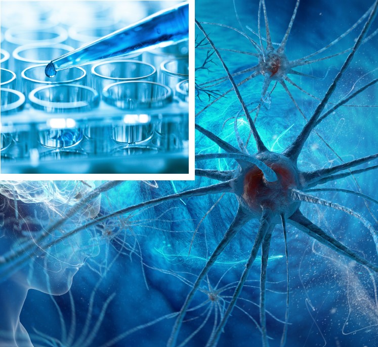 Marqueurs neuroimmunologiques BÜHLMANN