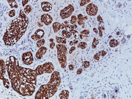 Anticorps d’Immunohistochimie