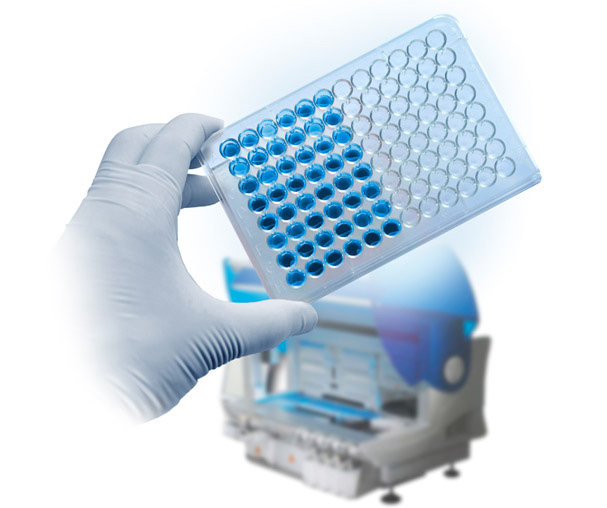 BÜHLMANN Calprotectin ELISA