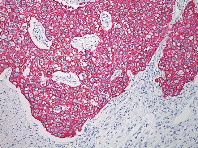 Immunohistochemistry detection kits and chromogens