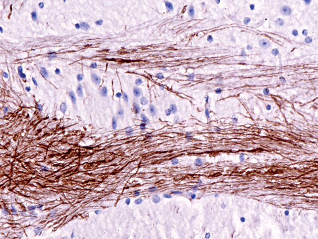 Trousse de détection d’immunohistochimie animale