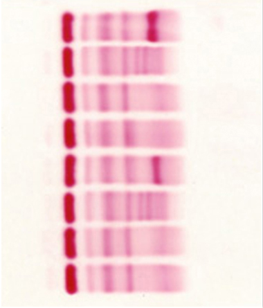 Helena Titan Cellulose Acetate and Agar